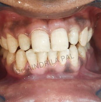 Oral-2