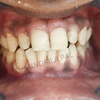 Oral-2