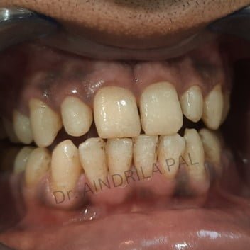 oral-1