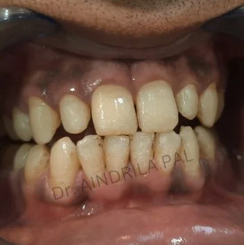 oral-1
