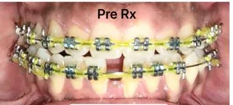 ortho-1