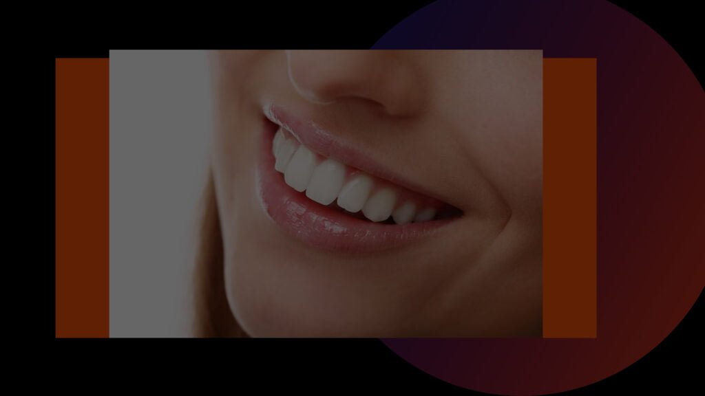 Teeth Whitening in Kolkata