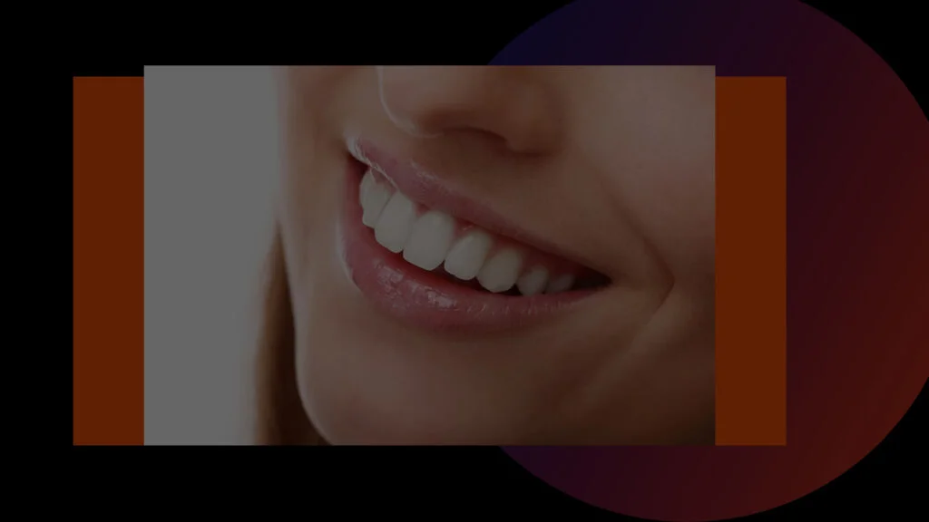 Teeth Whitening in Kolkata
