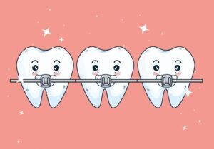 Retainers
