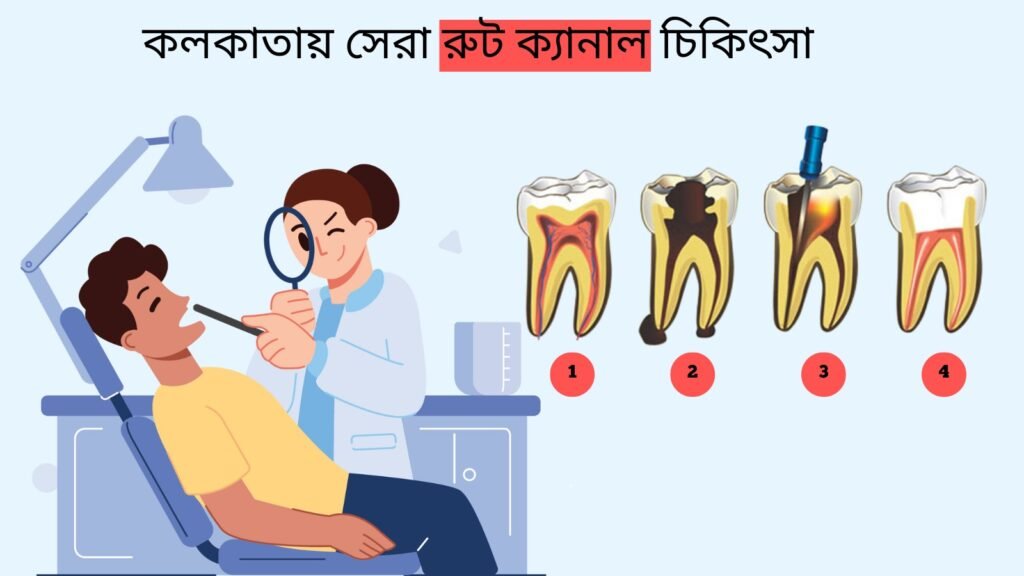 কলকাতায় সেরা রুট ক্যানেল চিকিৎসা