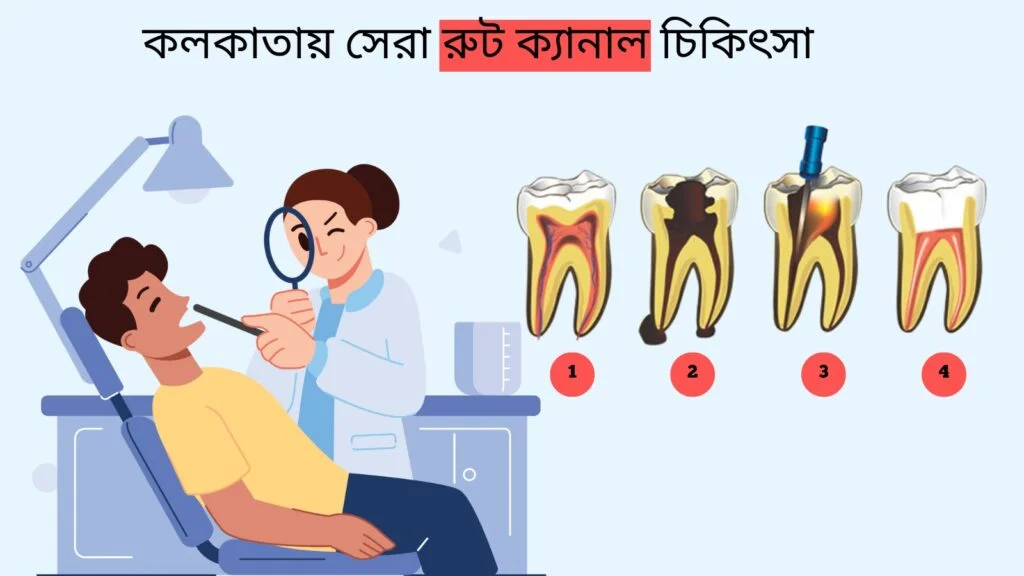 কলকাতায় সেরা রুট ক্যানেল চিকিৎসা