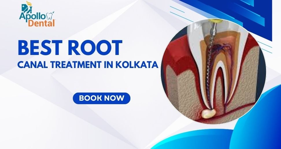 Best Root Canal Treatment in Kolkata Painless Procedure & Recovery