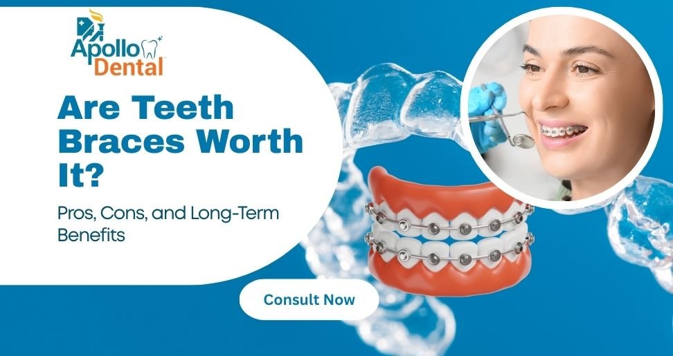 Are Teeth Braces Worth It? Pros, Cons, and Long-Term Benefits | Apollo Dental