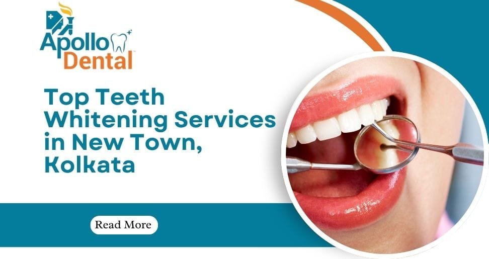 Top Teeth Whitening Services in New Town, Kolkata | Apollo Dental Clinic