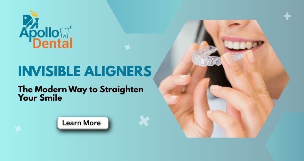 Invisible Aligners Newtown Kolkata