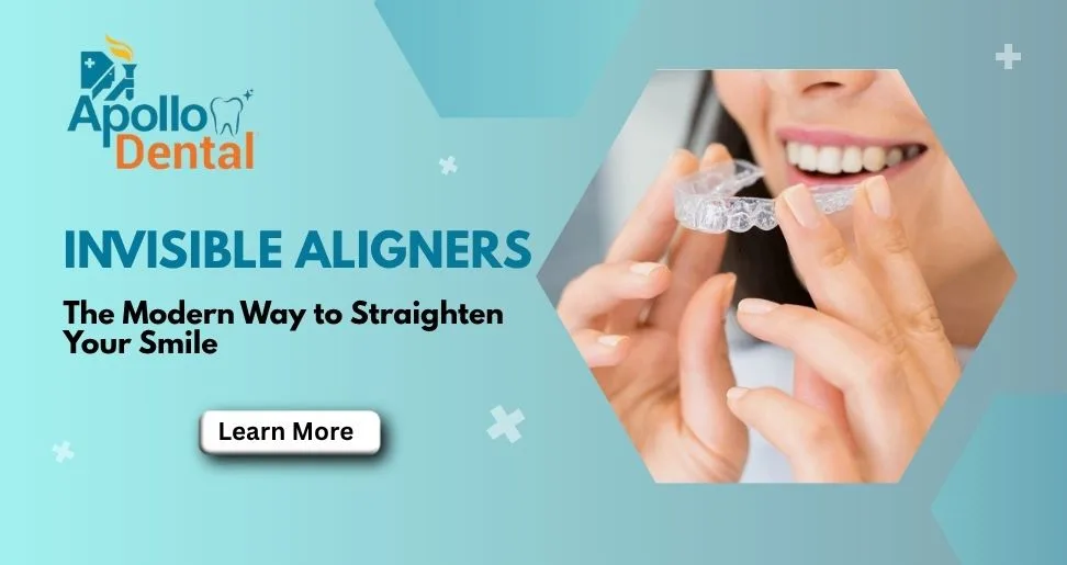 Invisible Aligners Newtown Kolkata