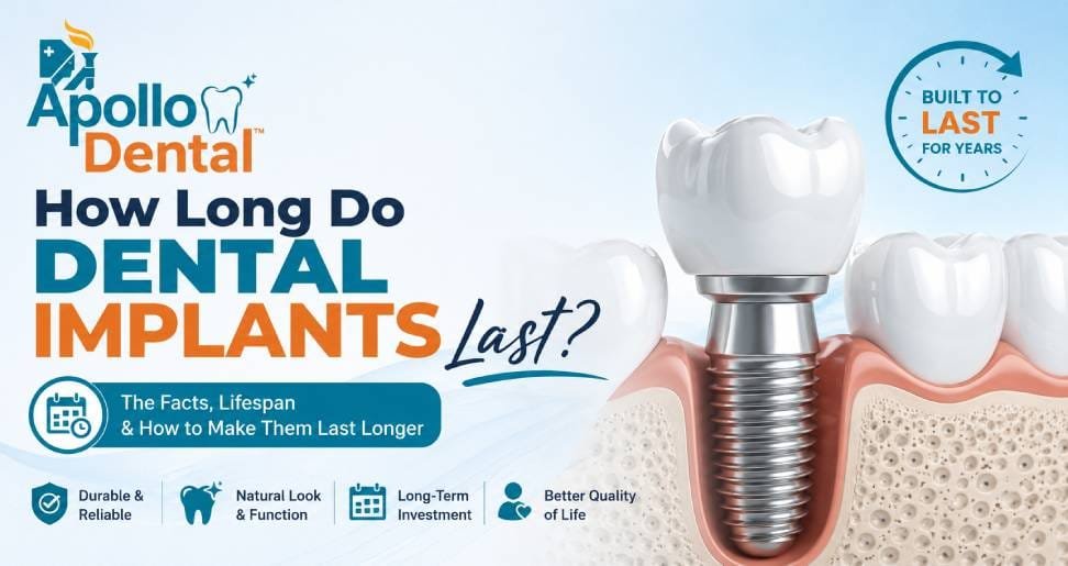 How Long Do Dental Implants Last