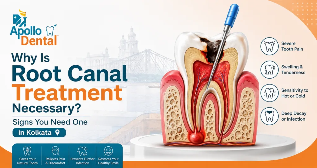 Why Is Root Canal Treatment Necessary? | Kolkata Guide