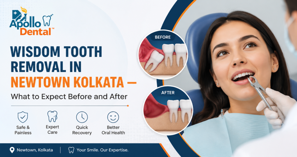 Wisdom Tooth Removal in Newtown Kolkata | Apollo Dental Clinic