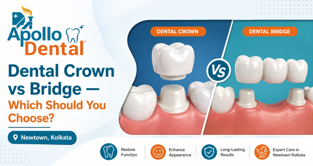 Dental Crown vs Bridge in Newtown Kolkata | Apollo Dental Clinic