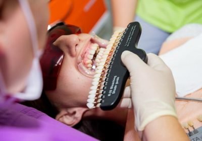 dental-crown tretment
